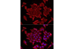 Immunofluorescence analysis of U2OS cells using TIMM17A antibody. (TIMM17A Antikörper  (AA 1-171))