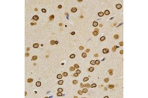 Immunohistochemistry (IHC) image for anti-Lamin A/C (LMNA) (AA 403-572) antibody (ABIN3020785)