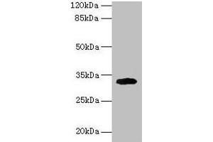 Western blot All lanes: Cd74 antibody at 2 μg/mL + Mouse lung tissue Secondary Goat polyclonal to rabbit IgG at 1/10000 dilution Predicted band size: 32, 25 kDa Observed band size: 32 kDa (CD74 Antikörper  (AA 57-280))