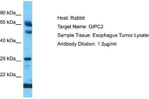 Host: Rabbit Target Name: GIPC2 Sample Type: Esophagus Tumor lysates Antibody Dilution: 1. (GIPC2 Antikörper  (C-Term))