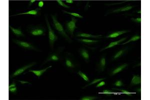 Immunofluorescence of monoclonal antibody to CALCOCO2 on HeLa cell. (CALCOCO2 Antikörper  (AA 347-446))