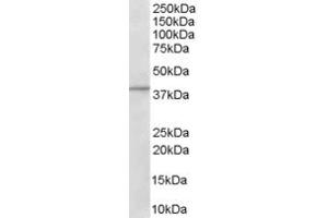 Western Blotting (WB) image for anti-ArfGAP with Dual PH Domains 1 (ADAP1) (C-Term) antibody (ABIN2465521) (ADAP1 Antikörper  (C-Term))