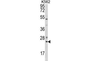 Western Blotting (WB) image for anti-RAB7A, Member RAS Oncogene Family (RAB7A) antibody (ABIN3003858) (RAB7A Antikörper)