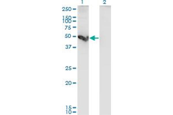 Cathepsin E Antikörper  (AA 18-396)