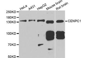 Western blot analysis of extracts of various cell lines, using CENPC antibody (ABIN5973936) at 1/1000 dilution. (Centromere Protein C Pseudogene 1 (CENPCP1) Antikörper)