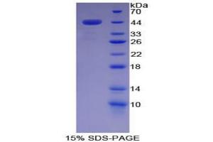 SDS-PAGE analysis of Pig Complement Component 7 Protein. (C7 Protein)