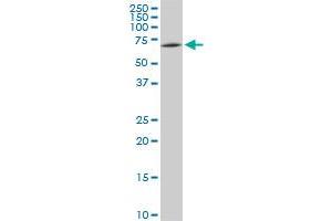 Western Blotting (WB) image for anti-SWAP Switching B-Cell Complex 70kDa Subunit (SWAP70) (AA 378-451) antibody (ABIN524958)