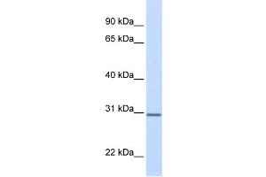 WB Suggested Anti-DCI Antibody Titration:  0. (DCI Antikörper  (N-Term))