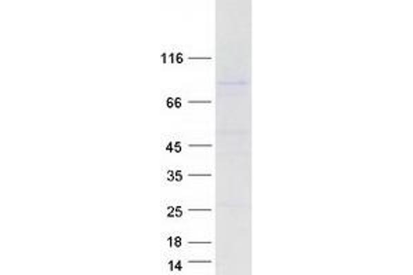 URI1 Protein (Transcript Variant 1) (Myc-DYKDDDDK Tag)