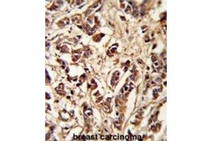 Immunohistochemistry (IHC) image for anti-Pericentriolar Material 1 (PCM1) antibody (ABIN3003242) (PCM1 Antikörper)