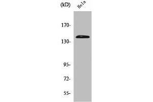 Western Blot analysis of Hela cells using PERK Polyclonal Antibody (PERK Antikörper  (N-Term))