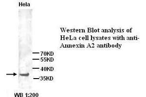 Image no. 1 for anti-Annexin A2 (ANXA2) (N-Term) antibody (ABIN1494341) (Annexin A2 Antikörper  (N-Term))