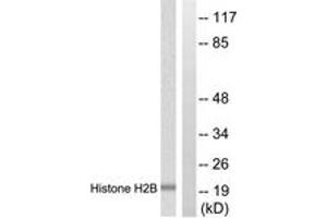 Western blot analysis of extracts from Raw264. (Histone H2B Antikörper  (AA 11-60))