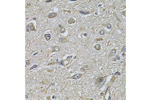 Immunohistochemistry of paraffin-embedded human brain cancer using WIPI1 Antibody (ABIN2560779) at dilution of 1:100 (40x lens). (WIPI1 Antikörper)