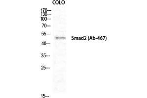 Western Blot analysis of COLO cells using Smad2 Polyclonal Antibody diluted at 1:1000. (SMAD2 Antikörper)