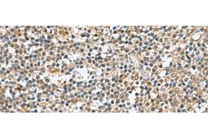 Immunohistochemistry of paraffin-embedded Human tonsil tissue using DNPH1 Polyclonal Antibody at dilution of 1:60(x200) (RCL Antikörper)