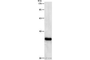 Western blot analysis of Hela cell, using PCNA Polyclonal Antibody at dilution of 1:500 (PCNA Antikörper)