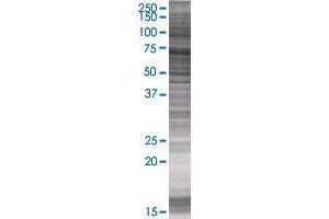 GLYATL1 transfected lysate. (GLYATL1 293T Cell Transient Overexpression Lysate(Denatured))