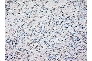 Immunohistochemical staining of paraffin-embedded Ovary tissue using anti-KRT8mouse monoclonal antibody. (KRT8 Antikörper  (AA 91-381))