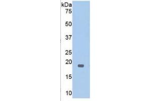 Western Blotting (WB) image for Thrombomodulin (THBD) ELISA Kit (ABIN6730904)