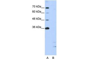 Western Blotting (WB) image for anti-Peptidylprolyl Isomerase E (Cyclophilin E) (PPIE) antibody (ABIN2462198) (PPIE Antikörper)