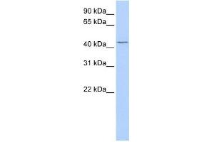 TRABD antibody used at 1 ug/ml to detect target protein. (TRABD Antikörper  (Middle Region))