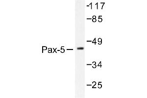 Image no. 1 for anti-Paired Box 5 (PAX5) antibody (ABIN271778) (PAX5 Antikörper)