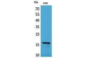 Western Blotting (WB) image for anti-Retinol Binding Protein 2, Cellular (RBP2) (Internal Region) antibody (ABIN3187894) (RBP2 Antikörper  (Internal Region))