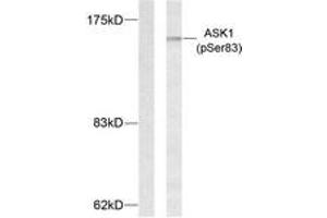 Western blot analysis of extracts from MDA-MB-435 cells treated with TNF-alpha, using ASK1 (Phospho-Ser83) Antibody. (ASK1 Antikörper  (pSer83))