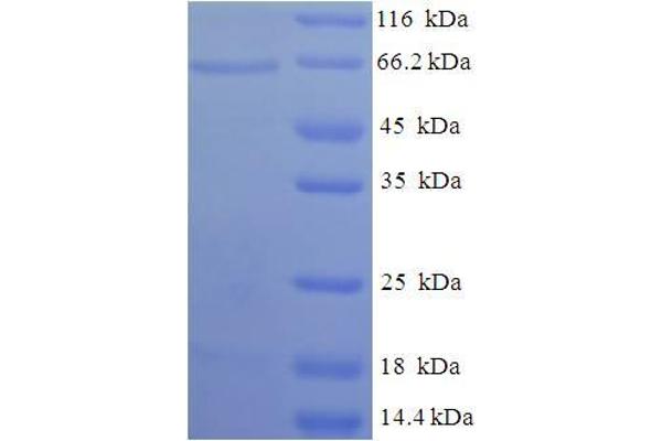 SDHD Protein (AA 1-440, full length) (His-SUMO Tag)