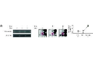 Western Blotting (WB) image for anti-Vimentin (VIM) antibody (ABIN2854814)