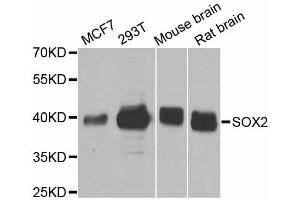 Western blot analysis of extracts of various cell lines, using SOX2 antibody. (SOX2 Antikörper)
