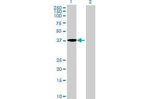 Western Blot analysis of MGC33407 expression in transfected 293T cell line by MGC33407 MaxPab polyclonal antibody. (MGC33407 (AA 1-416) Antikörper)