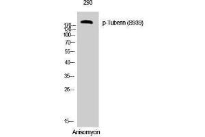 Western Blotting (WB) image for anti-Tuberous Sclerosis 2 (TSC2) (pSer939) antibody (ABIN3182562) (Tuberin Antikörper  (pSer939))