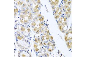 Immunohistochemistry of paraffin-embedded human stomach using TMEM43 antibody. (TMEM43 Antikörper)