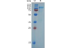 Human A7 Protein, His Tag on SDS-PAGE under reducing condition. (SLC4A7 Protein (AA 1-608) (His tag))
