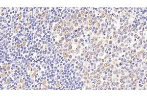 Detection of HSPA8 in Human Tonsil Tissue using Polyclonal Antibody to Heat Shock 70 kDa Protein 8 (HSPA8) (Hsc70 Antikörper  (AA 534-615))