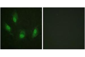 Immunofluorescence analysis of HeLa cells, using p53 (Ab-392) Antibody. (p53 Antikörper  (AA 344-393))