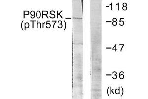 Western blot analysis of extracts from 293 cells treated with UV using p90 RSK (Phospho-Thr573) Antibody. (RPS6KA1 Antikörper  (pThr573))