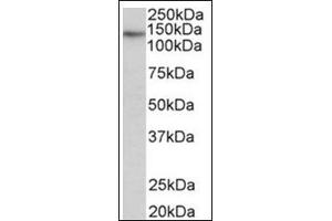 Staining of Skeletal Muscle lysate (35µg protein in RIPA buffer) using TERT antibody at 0. (TERT Antikörper  (Internal Region))