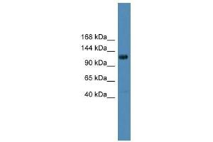 DGKQ antibody used at 0. (DGKQ Antikörper  (Middle Region))