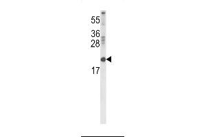 Western blot analysis of RBP2 Antibody in 293 cell line lysates (35ug/lane) (RBP2 Antikörper  (AA 56-84))