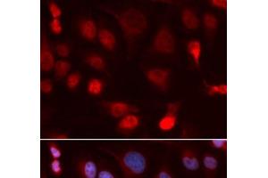 Immunofluorescence analysis of U2OS cells using ATP7B Polyclonal Antibody (ATP7B Antikörper)