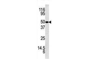 Western Blotting (WB) image for anti-Kallikrein 5 (KLK5) antibody (ABIN3002614) (Kallikrein 5 Antikörper)