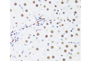 Immunohistochemistry of paraffin-embedded Rat liver using DDX39B Polyclonal Antibody at dilution of 1:100 (40x lens). (DDX39B Antikörper)
