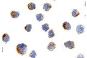 Immunohistochemistry (IHC) image for anti-Nerve Growth Factor Receptor (NGFR) antibody (ABIN1031777) (NGFR Antikörper)