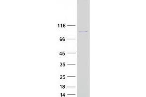 MAGED2 Protein (Transcript Variant 1) (Myc-DYKDDDDK Tag)