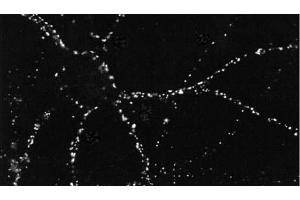 ICC of PSD95 in cultures of dissociated hippocampal neurons. (DLG4 Antikörper  (Atto 488))