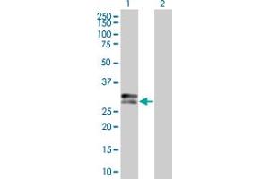 Lane 1: HLA-DPA1 transfected lysate ( 29. (HLA-DPA1 293T Cell Transient Overexpression Lysate(Denatured))