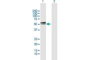 Western Blot analysis of PAX3 expression in transfected 293T cell line by PAX3 MaxPab polyclonal antibody. (Paired Box 3 Antikörper  (AA 1-484))